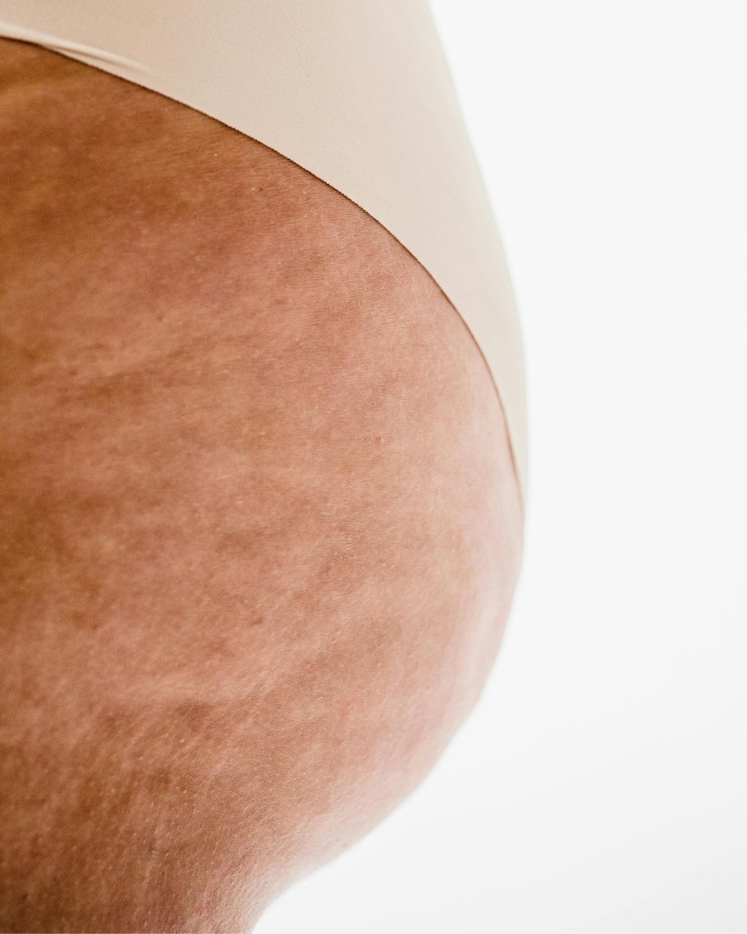 YPB intimate skincare guide: dark skin between the buttocks and gentle care